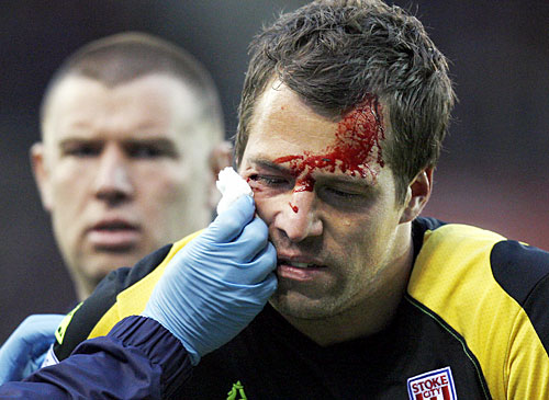 ����� ��������