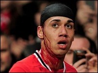 ���� ��������