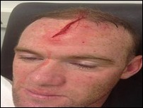 ���� ����