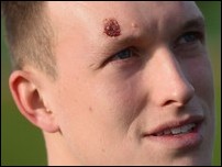 ��� �����