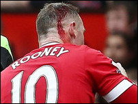 ���� ����