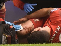 ���� ������