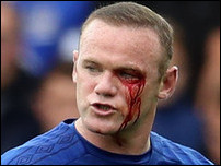 ���� ����