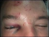 ����� ����������