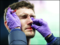 ������� ����������