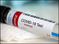 ���� �� COVID-19