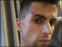 ���� �������